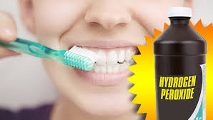 Hydrogen Peroxide for Teeth Whitening