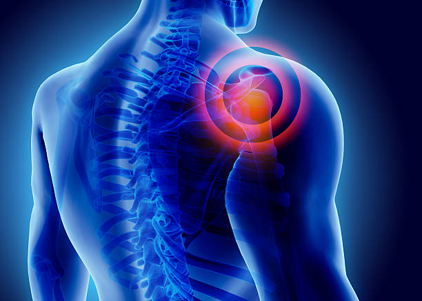 Pain o Soma 500mg? Analgesic For Muscle Pain
